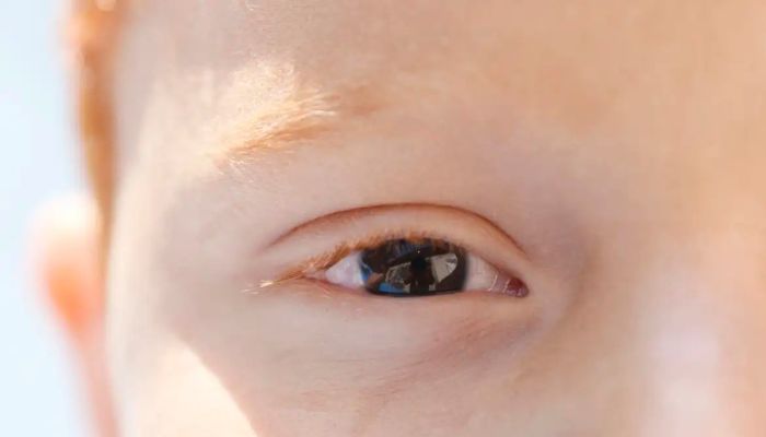 Cartilha sobre saúde ocular na infância orienta pais e professores 